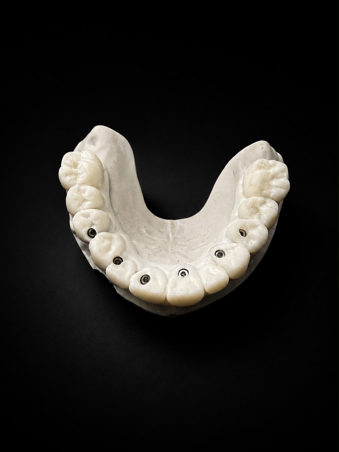 Coronas y puentes sobre implantes — Protdent
